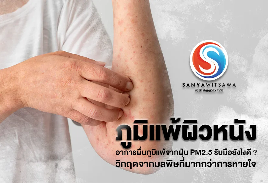 ภูมิแพ้ผิวหนัง อาการผื่นภูมิแพ้จากฝุ่น PM2.5 รับมือยังไงดี ? วิกฤตจากมลพิษที่มากกว่าการหายใจ